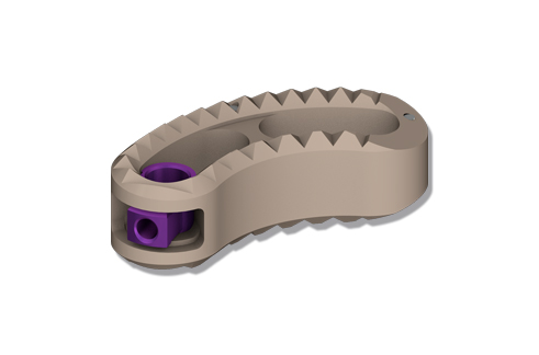 TLIF PEEK intervertebral cage - ChM sp. z o.o.
