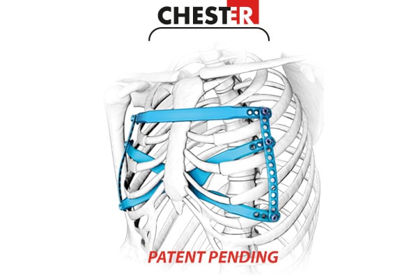 Chester® - system do leczenia deformacji klatki piersiowej - ChM sp. z o.o.